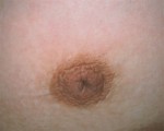 Nipple - Inversion Correction